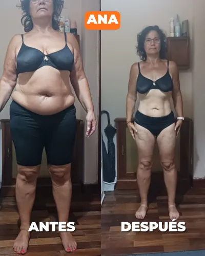 Ana — antes y después