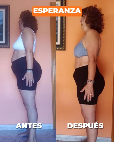 Esperanza — antes y después