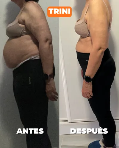 Trini — antes y después
